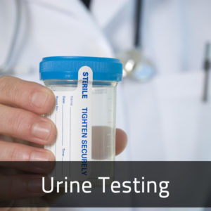 Urine Testing